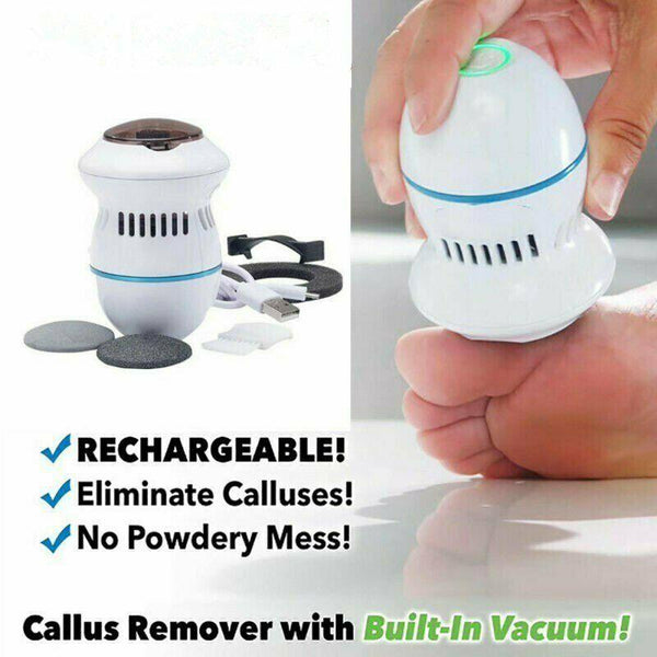 Electric corneal remover